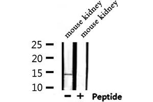Western blot analysis of extracts from mouse kidney, using MSS4 Antibody. (RABIF antibody  (N-Term))
