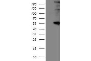 Western Blotting (WB) image for anti-Lysyl Oxidase (LOX) (AA 22-168) antibody (ABIN1491214) (LOX antibody  (AA 22-168))