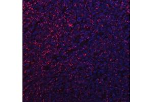 IF analysis of MFF using anti-MFF antibody (ABIN7599292). (MFF antibody  (AA 1-342))