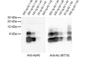 Detection of synthetic Abeta 1-38, 1-40 and 1-42 with anti-Abeta 40 (dilution 1 : 1000) and anti-Abeta (Cat. (Abeta 1-40 antibody  (AA 33-40))
