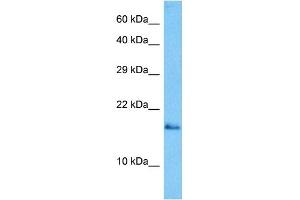 Host:  Mouse  Target Name:  GABARAP  Sample Tissue:  Mouse Skeletal Muscle  Antibody Dilution:  1ug/ml (GABARAP antibody  (N-Term))