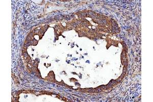 IHC analysis of RRS1 using anti-RRS1 antibody (ABIN7602918). (RRS1 antibody  (C-Term))