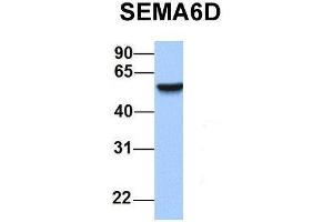 Host:  Rabbit  Target Name:  SEMA6D  Sample Type:  Human Adult Placenta  Antibody Dilution:  1. (SEMA6D antibody  (N-Term))