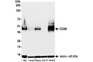 Western Blotting (WB) image for anti-CD48 (CD48) (AA 29-220) antibody (ABIN7795687)