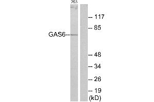 Immunohistochemistry analysis of paraffin-embedded human brain tissue using GAS6 antibody.