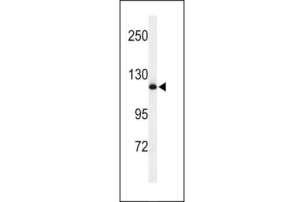 NEDD4 antibody  (C-Term)