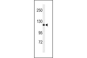 NEDD4 antibody  (C-Term)