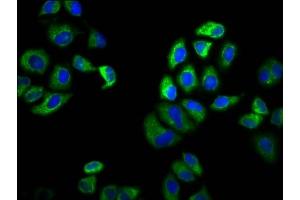 Immunofluorescence staining of Hela cells with ABIN7169980 at 1:100, counter-stained with DAPI. (SLC6A19 antibody  (AA 326-413))