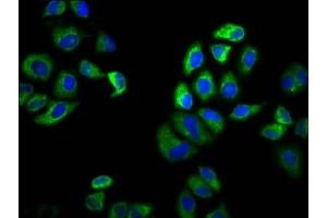Immunofluorescence staining of Hela cells with ABIN7169980 at 1:100, counter-stained with DAPI. (SLC6A19 antibody  (AA 326-413))