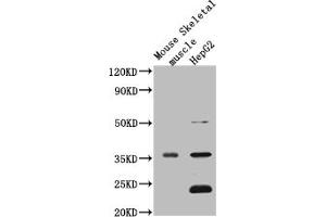 Western Blot Positive WB detected in: Mouse heart tissue, Mouse liver tissue, Mouse kidney tissue, Mouse brain tissue, Mouse skeletal muscle tissue, Mouse stomach tissue All lanes: MTND1 antibody at 3 μg/mL Secondary Goat polyclonal to rabbit IgG at 1/50000 dilution Predicted band size: 36 kDa Observed band size: 36 kDa (MT-ND1 antibody  (AA 23-67))