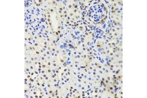 Immunohistochemistry of paraffin-embedded mouse kidney using EFTUD2 Antibody (ABIN5974236) at dilution of 1/100 (40x lens). (EFTUD2 antibody)