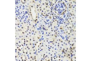 Immunohistochemistry of paraffin-embedded mouse kidney using EFTUD2 Antibody (ABIN5974236) at dilution of 1/100 (40x lens).