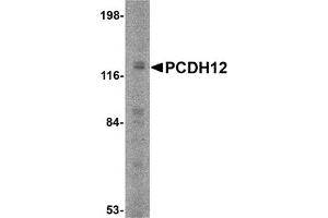 Western Blotting (WB) image for anti-Protocadherin 12 (PCDH12) (N-Term) antibody (ABIN1031505) (PCDH12 antibody  (N-Term))