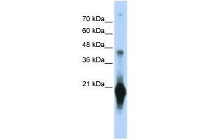 WB Suggested Anti-C17orf49 Antibody Titration: 0. (C17orf49 antibody  (Middle Region))