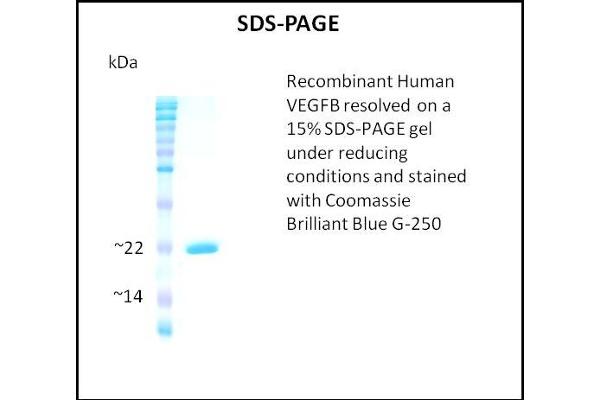 VEGFB Protein