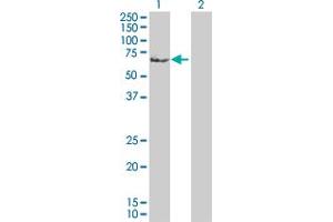 Western Blot analysis of HDAC2 expression in transfected 293T cell line by HDAC2 MaxPab polyclonal antibody. (HDAC2 antibody  (AA 1-582))