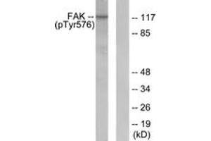 Western blot analysis of extracts from NIH-3T3 cells, using FAK (Phospho-Tyr576) Antibody. (FAK antibody  (pTyr576))