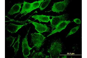 Immunofluorescence of monoclonal antibody to YKT6 on HeLa cell. (YKT6 antibody  (AA 99-198))