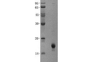 Validation with Western Blot (Cytochrome b5 (CYTB5) (Transcript Variant 3) protein (His tag))