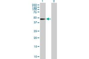 Western Blot analysis of ZNF193 expression in transfected 293T cell line by ZNF193 MaxPab polyclonal antibody. (Zinc Finger and SCAN Domain Containing 9 (ZSCAN9) (AA 1-394) antibody)
