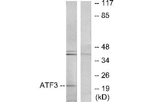 Western blot analysis of extracts from RAW264. (ATF3 antibody)