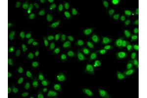 Immunofluorescence analysis of MCF-7 cells using SND1 antibody. (SND1 antibody  (AA 26-285))