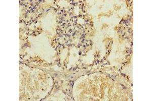 Immunohistochemistry of paraffin-embedded human lung tissue using ABIN7147376 at dilution of 1:100 (PLK1S1 antibody  (AA 1-240))