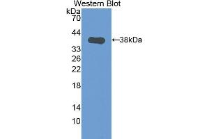 Detection of Recombinant CK1, Mouse using Polyclonal Antibody to Cytokeratin 1 (CK1) (Cytokeratin 1 antibody  (AA 189-497))
