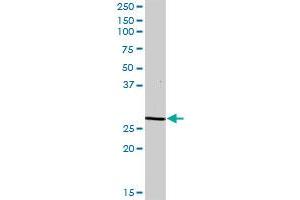 DCI MaxPab polyclonal antibody. (DCI antibody  (AA 1-243))