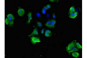 Immunofluorescent analysis of MCF-7 cells using ABIN7170803 at dilution of 1:100 and Alexa Fluor 488-congugated AffiniPure Goat Anti-Rabbit IgG(H+L)