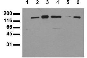Western Blotting (WB) image for anti-Receptor Tyrosine-Protein Kinase ErbB-3 (ERBB3) (C-Term) antibody (ABIN126793) (ERBB3 antibody  (C-Term))