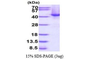 SDS-PAGE (SDS) image for Speckle-Type POZ Protein (SPOP-B) (AA 1-374) protein (His tag) (ABIN667901) (SPOP-B Protein (AA 1-374) (His tag))