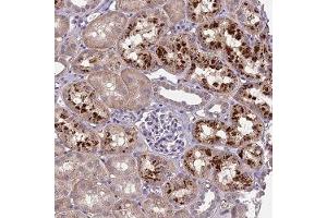 Immunohistochemical staining of human kidney with CEACAM16 polyclonal antibody ( Cat # PAB28301 ) shows strong granular cytoplasmic positivity in cells in tubules.