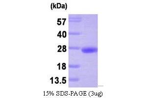 SDS-PAGE (SDS) image for Protein Tyrosine Phosphatase Type IVA, Member 3 (PTP4A3) (AA 1-173) protein (His tag) (ABIN666667) (PTP4A3 Protein (AA 1-173) (His tag))