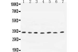 Anti- Cyclin D1 antibody, All Western blottingAll lanes: Anti-CCND1 at 0. (Cyclin D1 antibody  (N-Term))