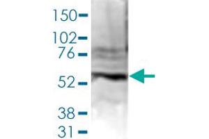 Western Blot (Cell lysate) analysis of 40 ug nuclear extracts of Hela cells. (PAPD5 antibody  (C-Term))