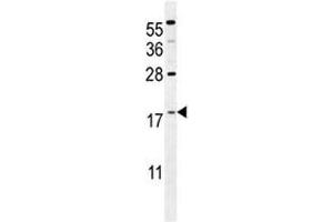 S100A4 antibody western blot analysis in mouse NIH3T3 lysate. (s100a4 antibody  (AA 1-30))