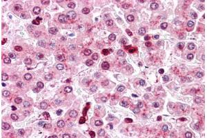 Human Liver: Formalin-Fixed, Paraffin-Embedded (FFPE) (COMT antibody  (Internal Region))