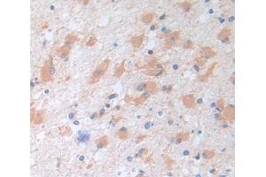 Used in DAB staining on fromalin fixed paraffin- embedded brain tissue (TRIM3 antibody  (AA 2-152))