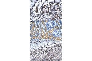 Immunohistochemical staining (Formalin-fixed paraffin-embedded sections) of human stomach (A), human kidney (B) and human heart (C) with HCLS1 polyclonal antibody  at 4-8 ug/mL working concentration. (HCLS1 antibody  (N-Term))