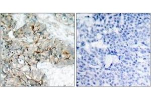 Immunohistochemistry (IHC) image for anti-Integrin beta 3 (ITGB3) (AA 739-788), (pTyr773) antibody (ABIN1531874)