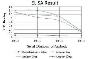 Red: Control Antigen (100 ng), Purple: Antigen (10 ng), Green: Antigen (50 ng), Blue: Antigen (100 ng), (MMP1 antibody)