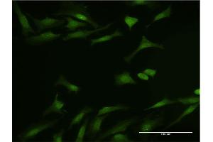 Immunofluorescence (IF) image for anti-Dynein, Light Chain, LC8-Type 1 (DYNLL1) (AA 1-72) antibody (ABIN522102)