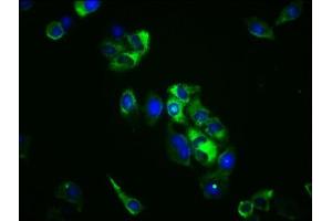 Immunofluorescence staining of Hela cells with ABIN7171265 at 1:100, counter-stained with DAPI. (STXBP5 antibody  (AA 515-610))
