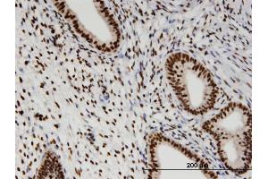 Immunoperoxidase of monoclonal antibody to RBM3 on formalin-fixed paraffin-embedded human endometrium. (RBM3 antibody  (AA 1-80))