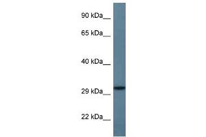 WB Suggested Anti-STX11 Antibody Titration: 1.