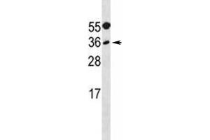 MYF5 antibody western blot analysis in A549 lysate. (MYF5 antibody  (AA 7-36))