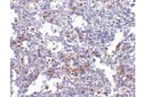 Immunohistochemistry of EVER1 in human spleen with EVER1 antibody at 2. (TMC6 antibody  (N-Term))