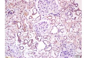 Formalin-fixed and paraffin embedded human kidney labeled with Anti-Wnt16 Polyclonal Antibody, Unconjugated (ABIN1387899) at 1:200 followed by conjugation to the secondary antibody and DAB staining (WNT16 antibody  (AA 220-265))