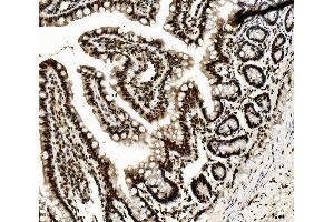 IHC analysis of DDX5 using anti-DDX5 antibody (ABIN7602561).